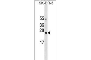 AGTR Antibody (C-term) 18437b western blot analysis in SK-BR-3 cell line lysates (35 μg/lane). (AGTRAP antibody  (C-Term))