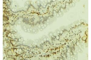 ABIN6277100 at 1/100 staining Mouse colon tissue by IHC-P. (SMARCA4 antibody  (N-Term))