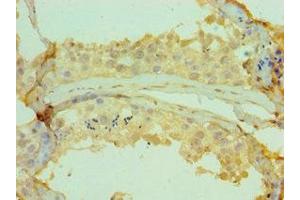 Immunohistochemistry of paraffin-embedded human testis tissue using ABIN7147353 at dilution of 1:100 (CETN2 antibody  (AA 1-172))
