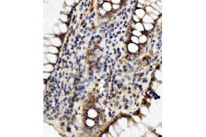 IHC analysis of MED4 using anti-MED4 antibody (ABIN7600817). (MED4 antibody  (AA 24-254))