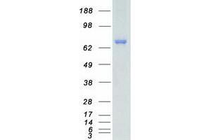Validation with Western Blot