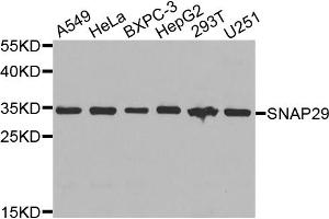 Western blot analysis of extracts of various cell lines, using SNAP29 antibody. (SNAP29 antibody)