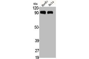 Western Blot analysis of HuvEc HELA cells using ADAMTS-1 Polyclonal Antibody (ADAMTS1 antibody  (Internal Region))