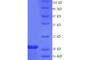 SDS-PAGE (SDS) image for Gap Junction Protein, alpha 1, 43kDa (GJA1) (AA 233-382), (Cytoplasmic Domain), (Cytosolic) protein (His tag) (ABIN5713124) (Connexin 43/GJA1 Protein (AA 233-382, Cytoplasmic Domain, Cytosolic) (His tag))