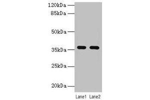 Western blot All lanes: LYPD3 antibody at 4 μg/mL Lane 1: MCF-7 whole cell lysate Lane 2: Mouse stomach tissue Secondary Goat polyclonal to rabbit IgG at 1/10000 dilution Predicted band size: 36 kDa Observed band size: 36 kDa (LYPD3 antibody  (AA 31-326))