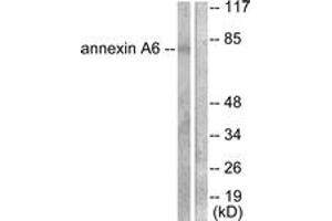Western blot analysis of extracts from 293 cells, using Annexin A6 Antibody.