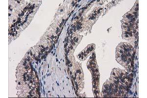 Image no. 2 for anti-Eukaryotic Translation Initiation Factor 4E Family Member 2 (EIF4E2) antibody (ABIN1497992) (EIF4E2 antibody)