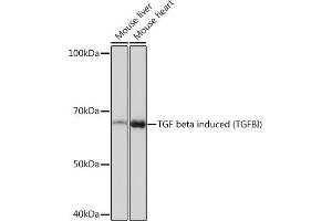 Western blot analysis of extracts of various cell lines, using TGF beta induced TGF beta induced (TGFBI) Rabbit mAb (ABIN7270915) at 1:1000 dilution. (TGFBI antibody)