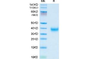 Layilin Protein (LAYN) (AA 22-235) (His tag)