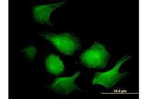 Immunofluorescence of monoclonal antibody to AK1 on HeLa cell. (Adenylate Kinase 1 antibody  (AA 1-194))