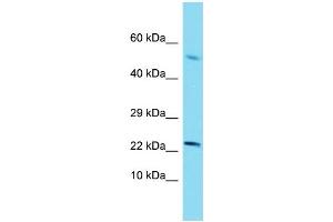Western Blotting (WB) image for anti-Sterol Carrier Protein 2 (SCP2) (N-Term) antibody (ABIN2774151) (SCP2 antibody  (N-Term))