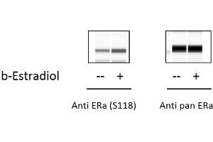 ZR751 cells were untreated or treated with b-estradiol for 1 hour. (Estrogen Receptor alpha ELISA Kit)