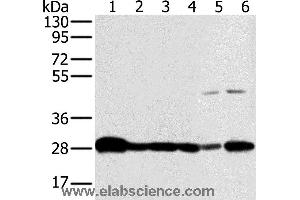 Western blot analysis of Mouse brain and human fetal brain tissue, hela, Raw264. (NDUFS3 antibody)