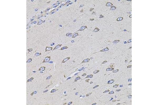 TMC1 antibody  (AA 600-700)