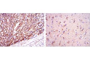Immunohistochemical analysis of paraffin-embedded liver cancer tissues (left) and brain tissues (right) using ApoE mouse mAb with DAB staining. (APOE antibody)
