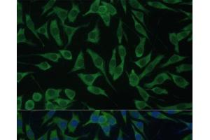 Immunofluorescence analysis of L929 cells using DDX3Y Polyclonal Antibody at dilution of 1:100 (40x lens). (DDX3Y antibody)
