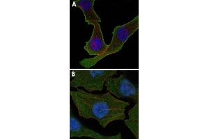 Confocal immunofluorescence analysis of SK-BR-3 (A) and A-549 (B) cells using CALR monoclonal antibody, clone 1G6A7  (green). (Calreticulin antibody)