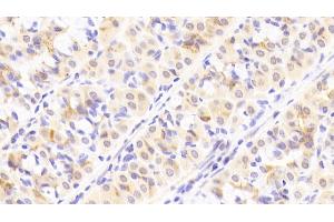Detection of ITGb8 in Human Stomach Tissue using Polyclonal Antibody to Integrin Beta 8 (ITGb8) (ITGB8 antibody  (AA 471-629))