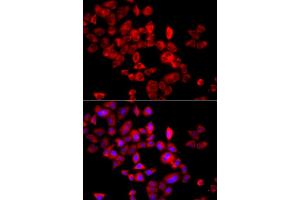 Immunofluorescence analysis of A549 cells using EIF4G1 antibody.