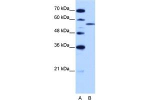 Western Blotting (WB) image for anti-Zinc Finger (CCCH Type), RNA-Binding Motif and serine/arginine Rich 2 (ZRSR2) antibody (ABIN2462182) (ZRSR2 antibody)