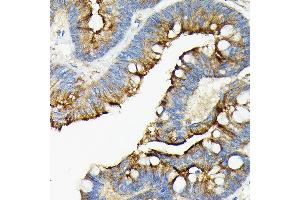 Immunohistochemistry of paraffin-embedded mouse kidney using  Rabbit pAb (ABIN6131167, ABIN6136429, ABIN6136430 and ABIN6216480) at dilution of 1:50 (40x lens).