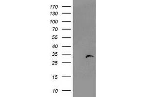 Western Blotting (WB) image for anti-Proteasome (Prosome, Macropain) Subunit, beta Type, 4 (PSMB4) antibody (ABIN1500471) (PSMB4 antibody)