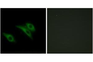 Immunofluorescence analysis of HeLa cells, using CD9 Antibody. (CD9 antibody  (AA 101-150))