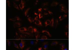 Immunofluorescence analysis of U-2 OS cells using RAB27A Polyclonal Antibody at dilution of 1:100. (RAB27A antibody)