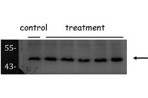 WB Image Sample (30 ug of whole cell lysate) A: Hela 10% SDS PAGE ORC4L antibody antibody diluted at 1:1000 (ORC4 antibody  (C-Term))
