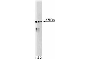 Western blot analysis of BAF47 on a mouse cerebrum lysate.