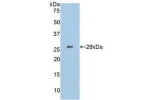 Detection of Recombinant COL1a1, Human using Polyclonal Antibody to Collagen Type I Alpha 1 (COL1a1) (COL1A1 antibody  (AA 1218-1440))