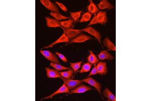 Immunofluorescence analysis of NIH/3T3 cells using GCN2 Rabbit pAb (ABIN6127829, ABIN6140031, ABIN6140033 and ABIN6216318) at dilution of 1:250 (40x lens). (GCN2 antibody  (AA 1-300))