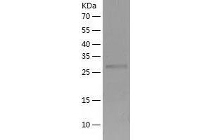 Western Blotting (WB) image for CTD (Carboxy-terminal Domain, RNA Polymerase II, Polypeptide A) Small Phosphatase 1 (CTDSP1) (AA 1-260) protein (His tag) (ABIN7288735) (CTDSP1 Protein (AA 1-260) (His tag))