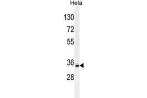 BCKDHB antibody  (N-Term)