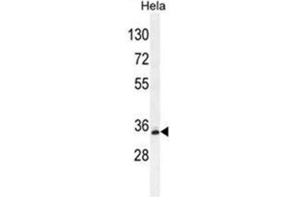 BCKDHB antibody  (N-Term)