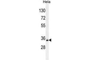 BCKDHB Antibody (N-term) western blot analysis in Hela cell line lysates (35µg/lane).