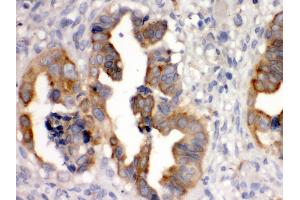 Immunohistochemistry (Paraffin-embedded Sections) (IHC (p)) image for anti-Sulfotransferase Family, Cytosolic, 2B, Member 1 (SULT2B1) (AA 190-218), (Middle Region) antibody (ABIN3043414) (SULT2B1 antibody  (Middle Region))