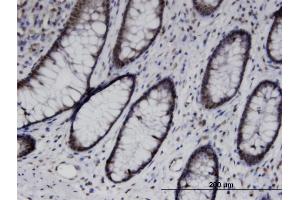 Immunoperoxidase of monoclonal antibody to UBASH3B on formalin-fixed paraffin-embedded human colon. (UBASH3B antibody  (AA 344-441))