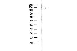 anti-Regulatory Factor X, 1 (Influences HLA Class II Expression) (RFX1) antibody