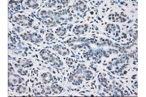 Immunohistochemical staining of paraffin-embedded breast tissue using anti-PPP5C mouse monoclonal antibody. (PP5 antibody)