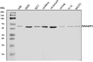 Western blot analysis of DMAP1 using anti-DMAP1 antibody (ABIN7601999).