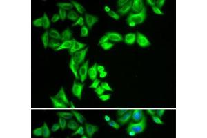 Immunofluorescence analysis of HeLa cells using STRN3 Polyclonal Antibody (STRN3 antibody)