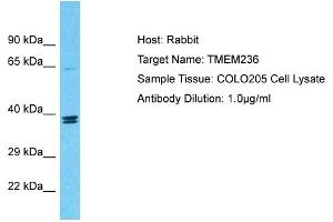 Host: Rabbit Target Name: TMEM236 Sample Tissue: Human COLO205 Whole Cell Antibody Dilution: 1ug/ml (TMEM236 antibody  (Middle Region))