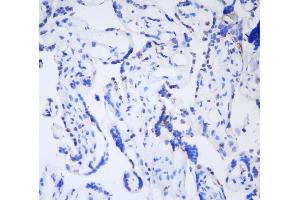 IHC analysis of HP1 gamma using anti-HP1 gamma antibody (ABIN5693033). (CBX3 antibody  (AA 2-183))