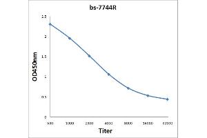 Antigen: 2 µg/100 µL  Primary: Antiserum, 1:500, 1:1000, 1:2000, 1:4000, 1:8000, 1:16000, 1:32000;  Secondary: HRP conjugated Rabbit Anti-Goat IgG at 1: 5000;  TMB staining Read the data in Microplate Reader by 450nm. (CHMP4B antibody  (AA 101-200))