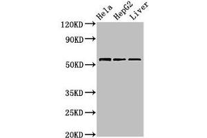 Western Blot Positive WB detected in: Hela whole cell lysate, HepG2 whole cell lysate, Mouse liver tissue All lanes: TOM1 antibody at 2. (TOM1 antibody  (AA 306-487))
