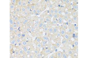 Immunohistochemistry of paraffin-embedded Rat liver using ASGR1 Polyclonal Antibody at dilution of 1:100 (40x lens). (Asialoglycoprotein Receptor 1 antibody)