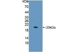 Detection of Recombinant IL10Rb, Human using Polyclonal Antibody to Interleukin 10 Receptor Beta (IL10Rb) (IL10RB antibody  (AA 87-243))