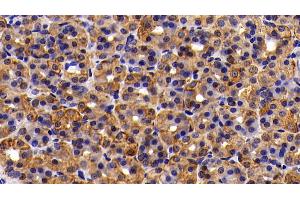 Detection of CK18 in Rat Stomach Tissue using Polyclonal Antibody to Cytokeratin 18 (CK18) (Cytokeratin 18 antibody  (AA 72-380))