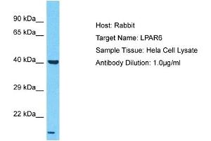 Host: Rabbit Target Name: LPAR6 Sample Type: Hela Whole Cell lysates Antibody Dilution: 1.